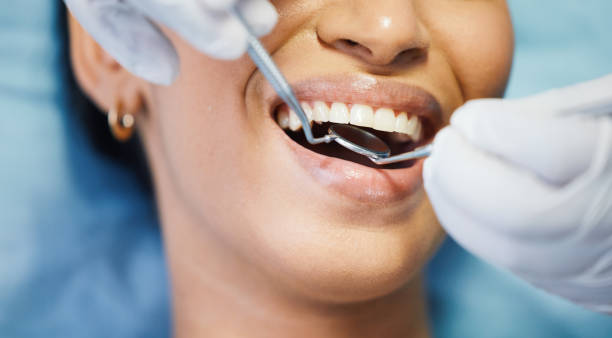 Best Emergency Treatment for Oral Infections in Key Vista, FL